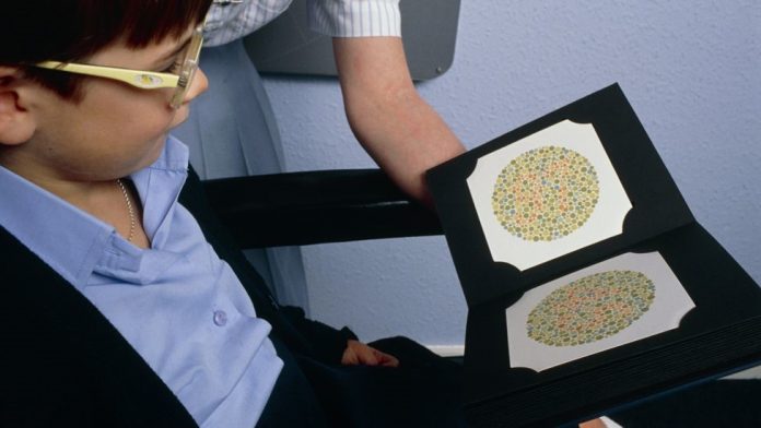 Nimcada Indhaha Iyo Arragga Midabka